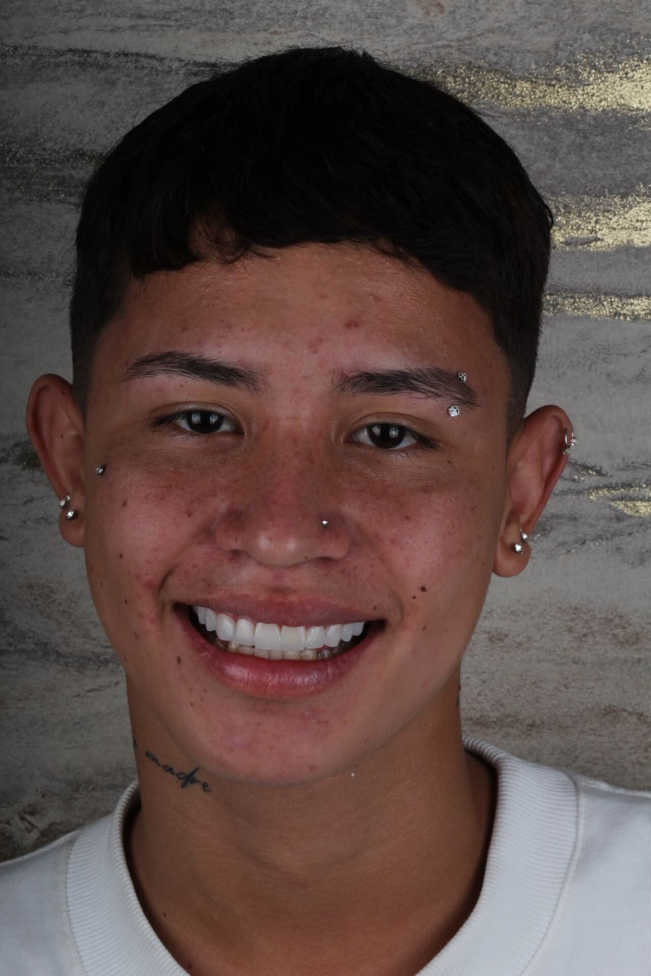 Caso real 14